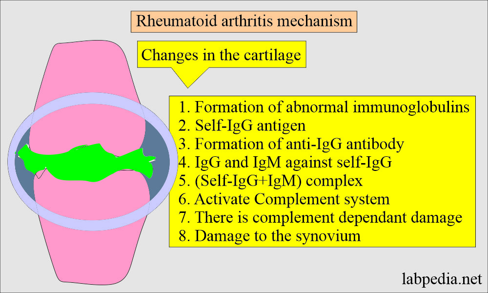 Rheumatoid arthritis mechanism of damage