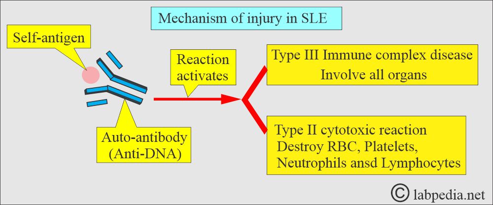 SLE Antigen and Antibody reaction SLE Antigen and Antibody reaction