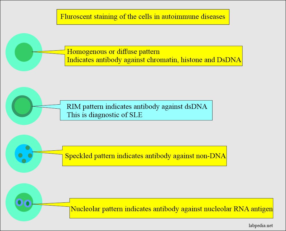 Fluorescent staining in autoimmune diseases