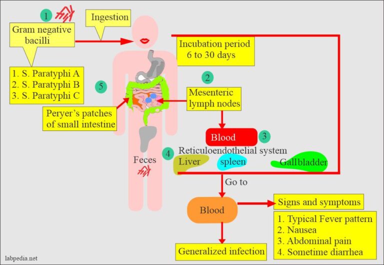 Salmonella Paratyphi, Paratyphoid Fever, Diagnosis And Treatment