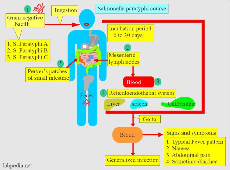 Salmonella Paratyphi, Paratyphoid Fever, Diagnosis and Treatment