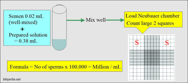 Semen Part 1 Semen Analysis Semen Examination And Semen Counting Procedure 