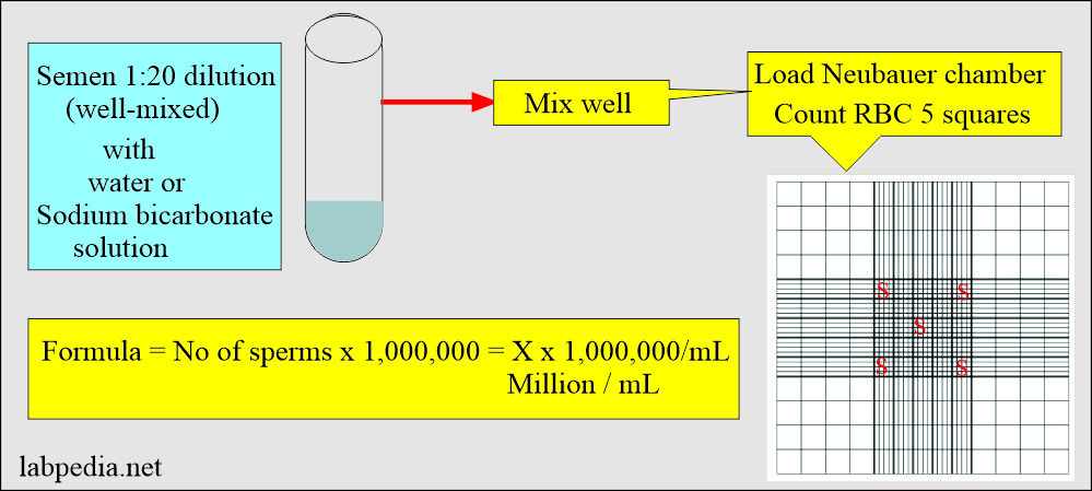Semen analysis: Semen counting formula