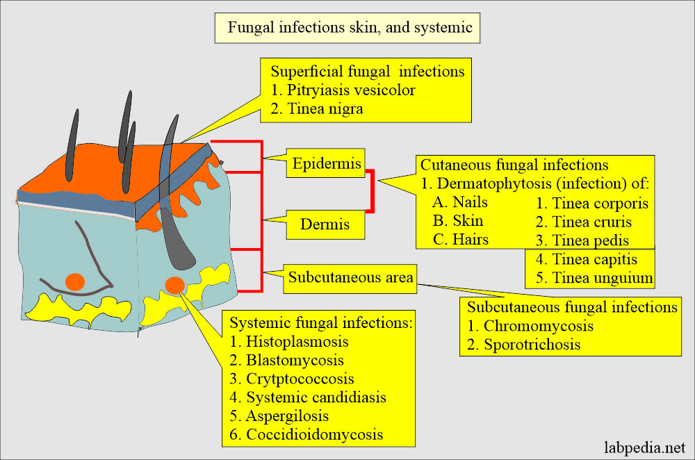 Skin fungal diseases