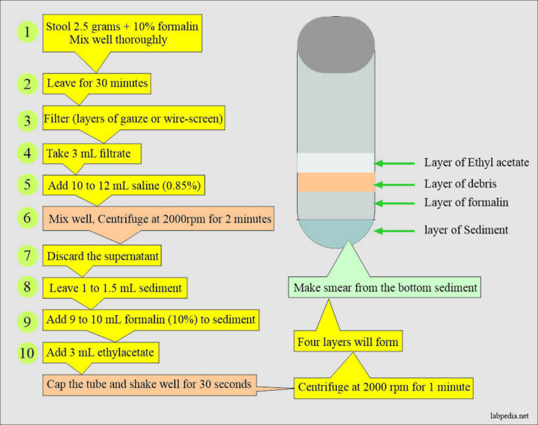 Stool Examination Part 3 Stool Smear Preparation, Stains, Handling, and Preservatives