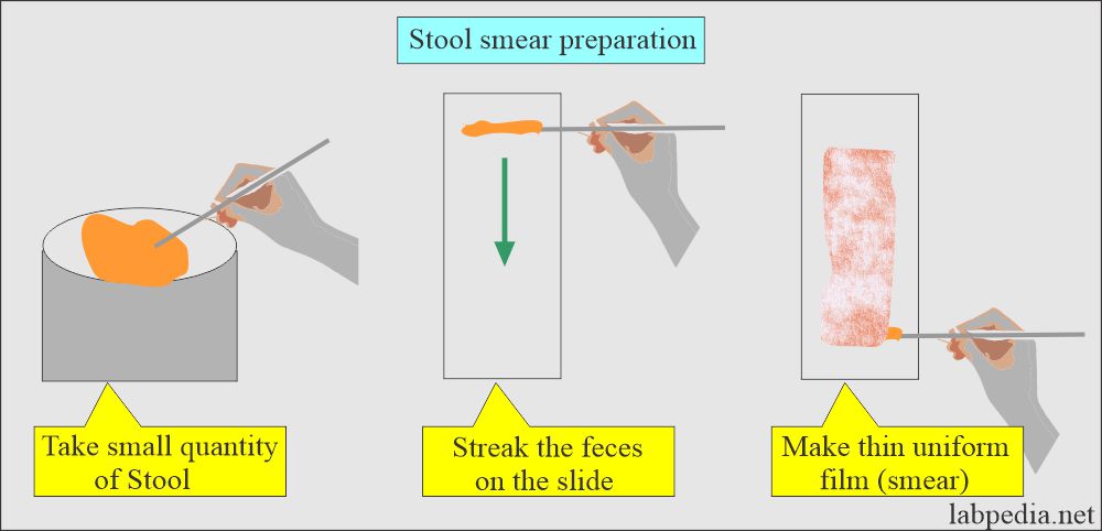 Stool smear preparation