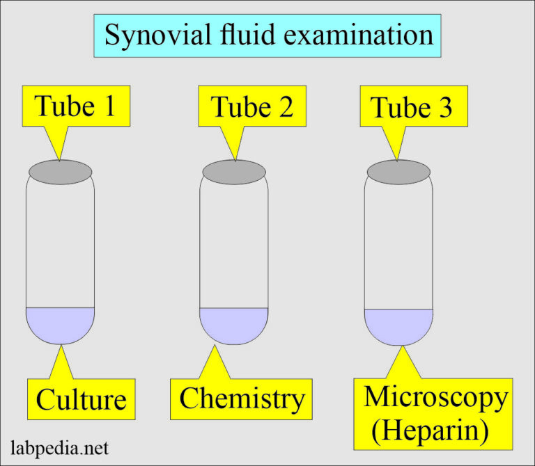 Fluid Analysis part 8 Synovial Fluid Analysis, Procedure for