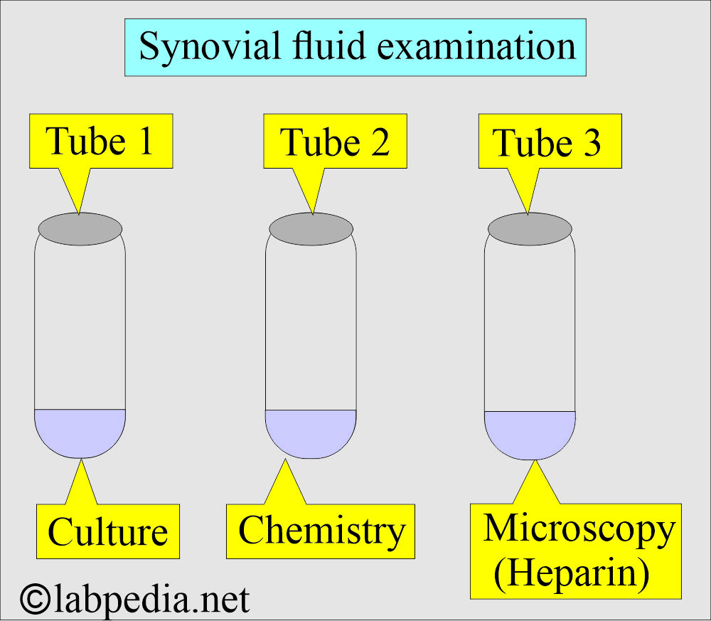 Synovial fluid examination Synovial fluid examination