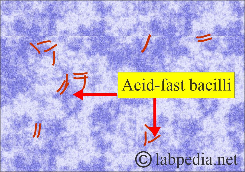 TB Acid-fast bacilli