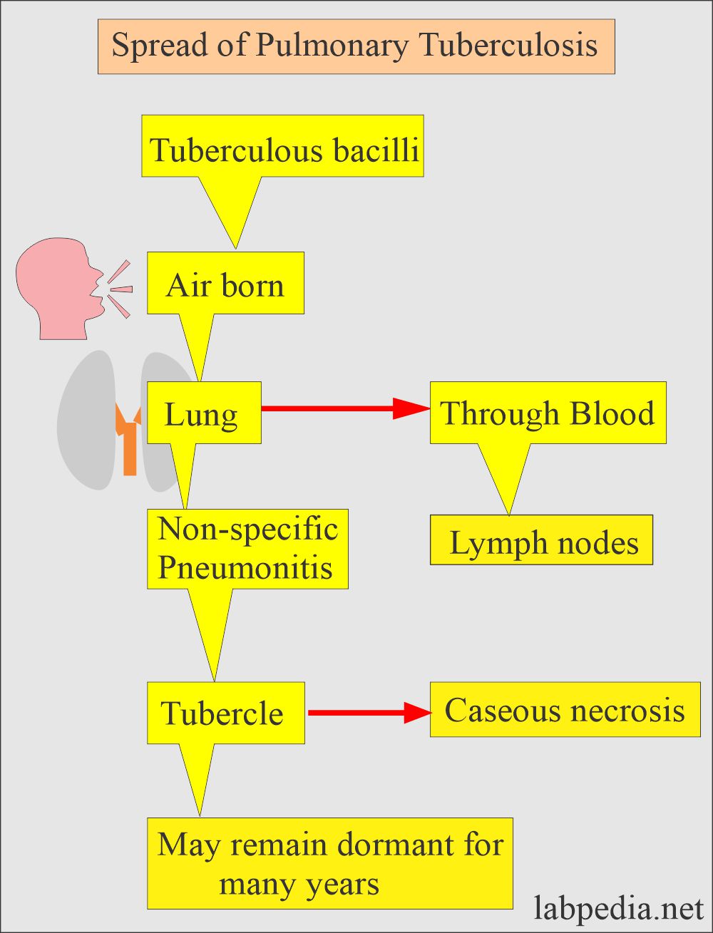 Spread of pulmonary tuberculosis