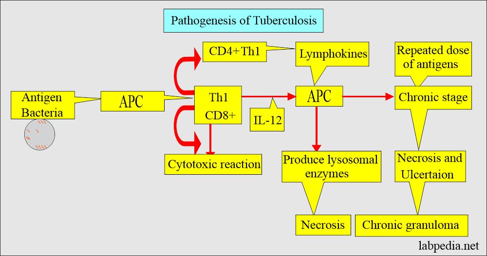 TB pathogenesis for type IV