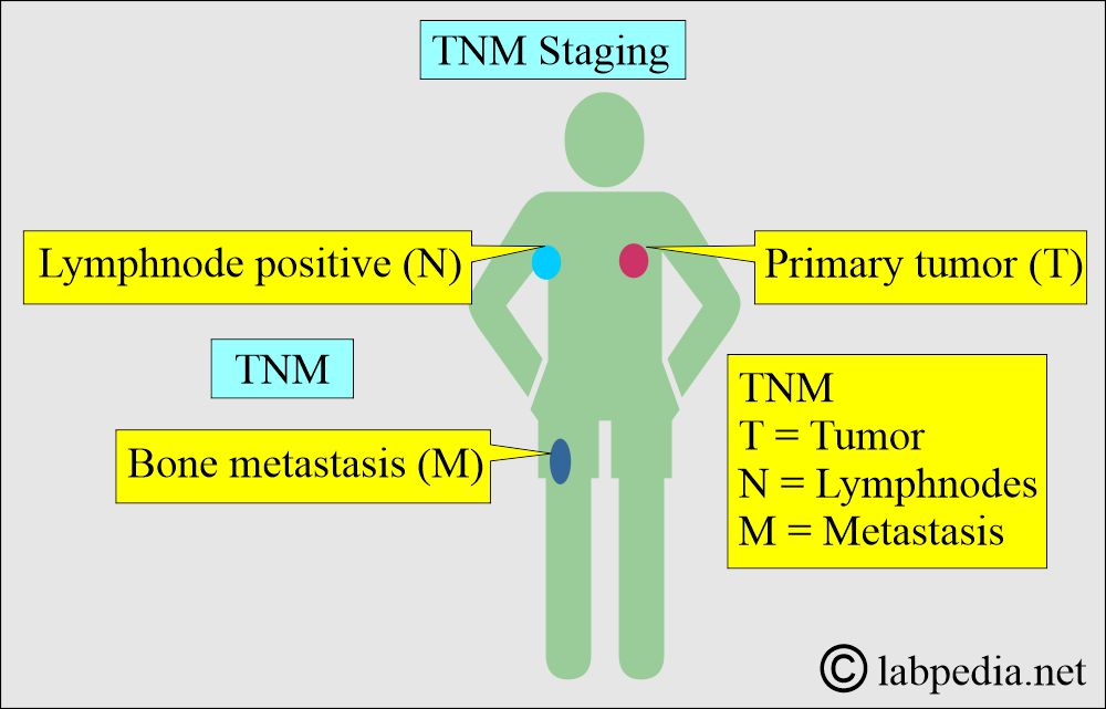 TNM staging TNM staging