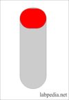 Types of Blood Samples, Criteria for rejection of the blood sample, Color coding of the blood sample tubes