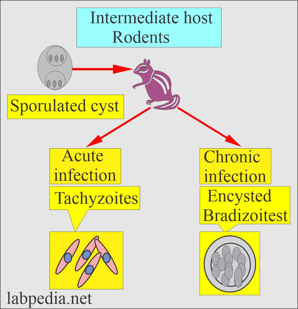 Toxoplasmosis acute and chronic stages