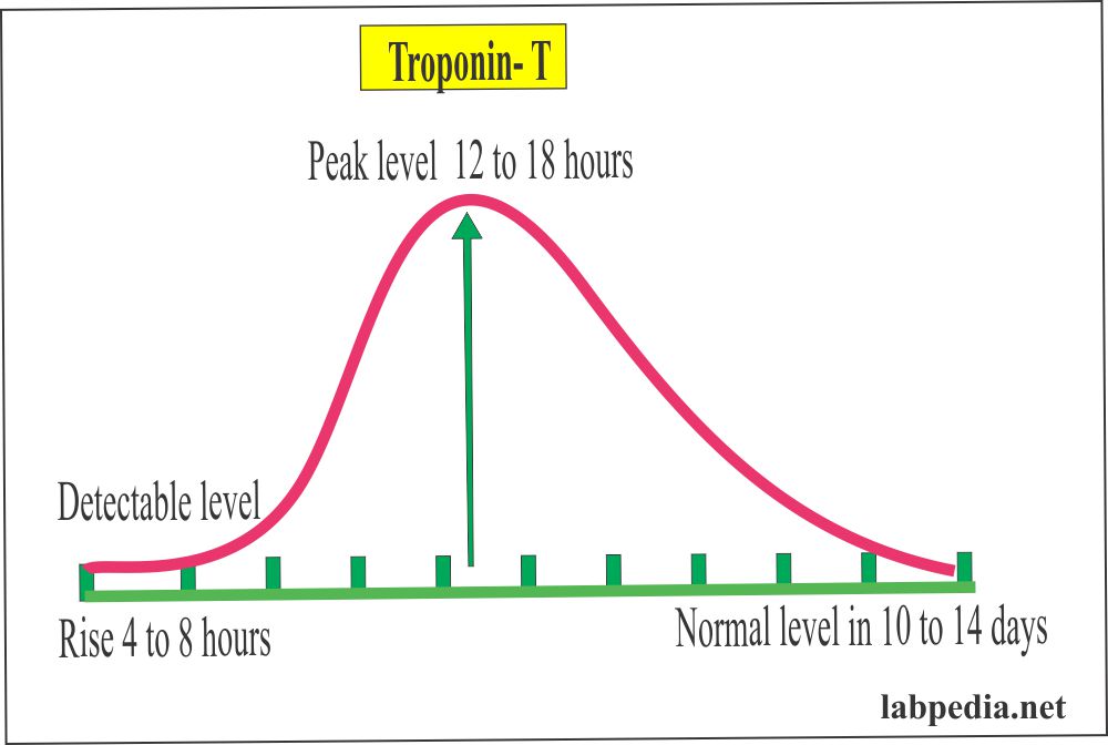 Cardiac Marker Part 1 Diagnosis Of Acute Myocardial Infarction Ami Labpedia Net