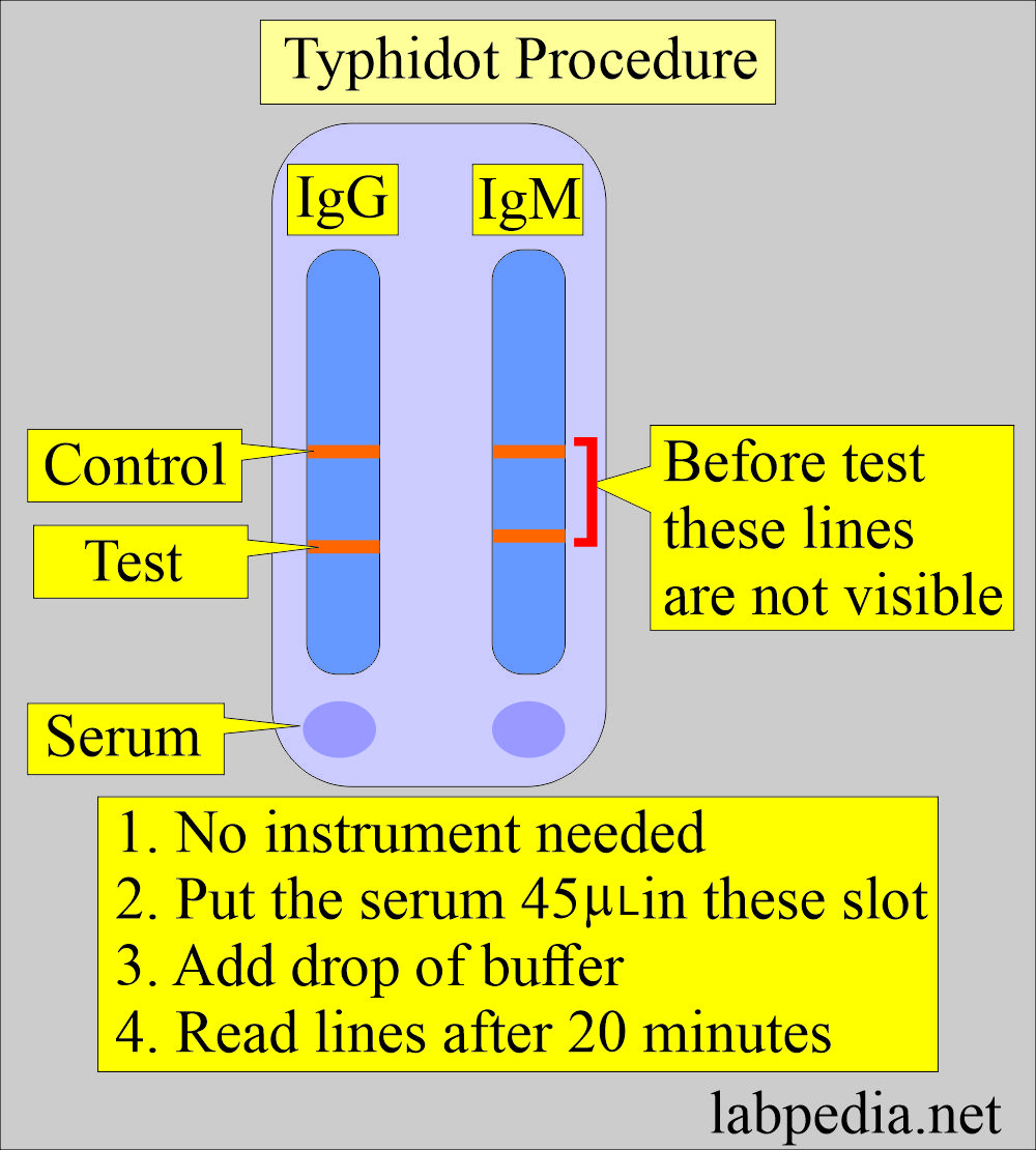 Typhidot test procedure