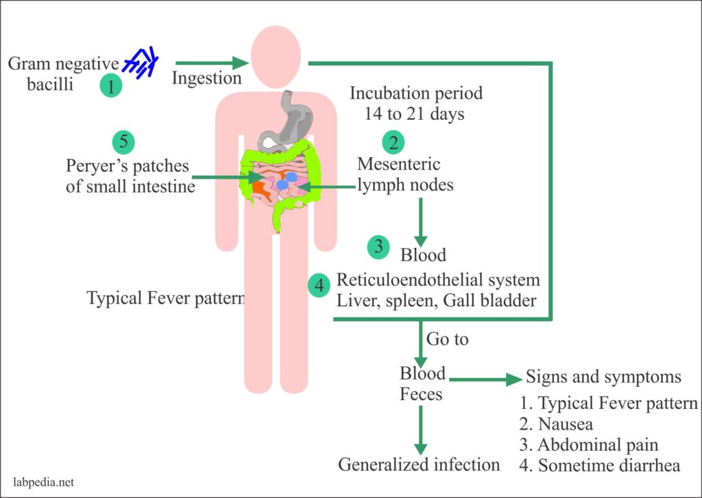 Enteric Fever Part 3 Typhoid Enteric Fever Diagnosis Widal Test 