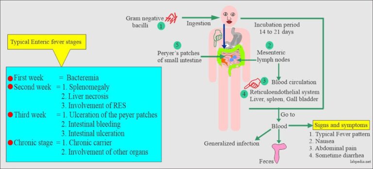 Enteric Fever – Part 1 – Typhoid Fever, Enteric Fever (Salmonella typhi