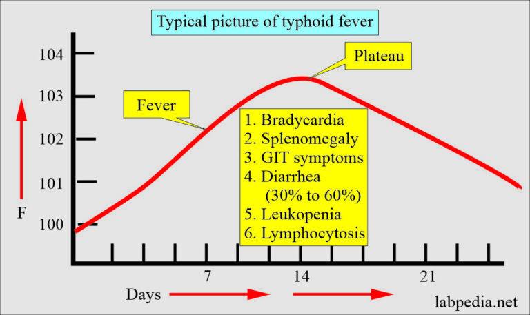 Enteric fever, widal test interpretations