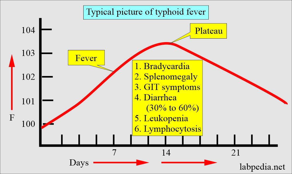 Typhoid fever typical symptoms