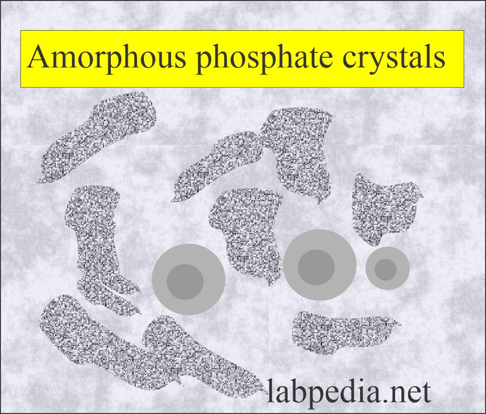 Urine Amorphous phosphates crystals