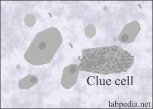 Urine Analysis:- Part 2 -Urine Microscopic Examination and ...