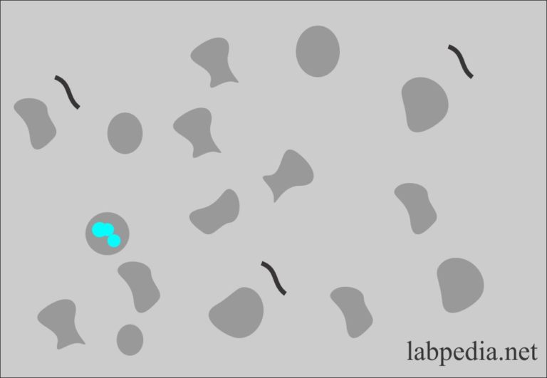 Urine Analysis:- Part 2 - Microscopic Examination And Interpretations ...