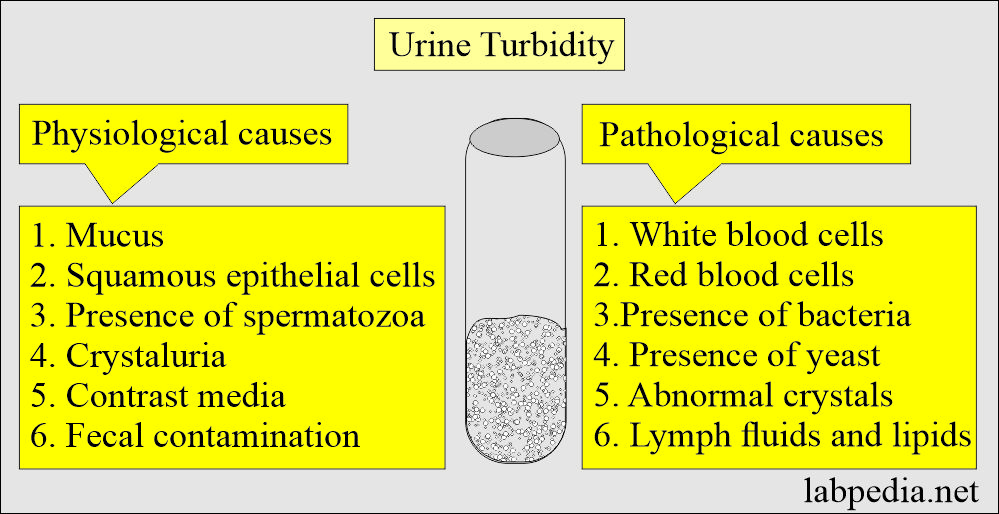 Urine analysis Turbidity