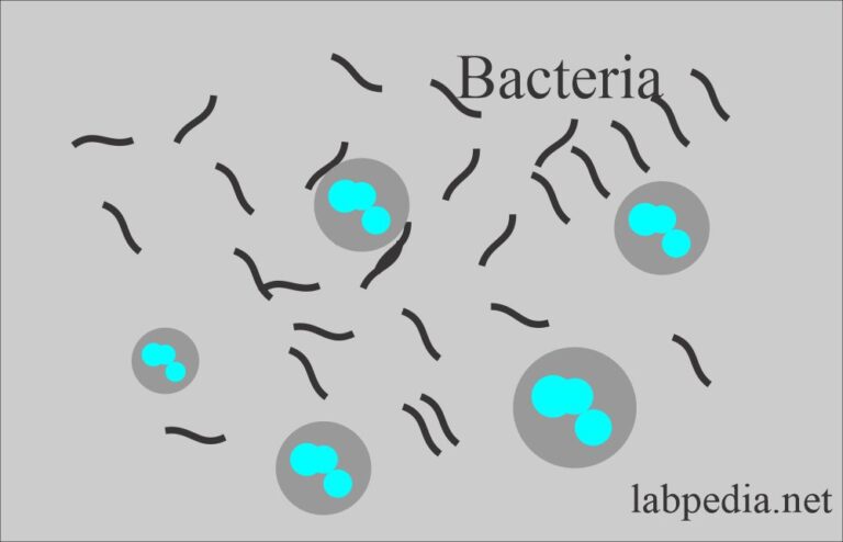 Urine Microscopic Examination, and Interpretations – Labpedia.net