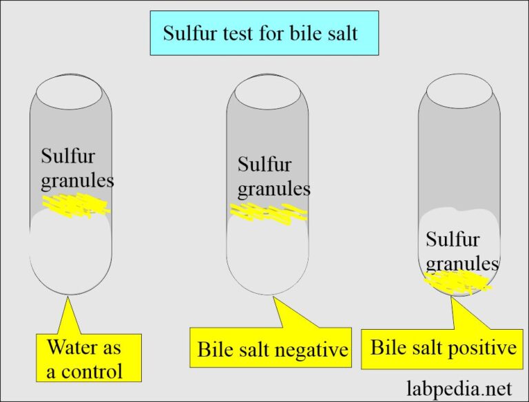 Urine For Bile pigments (Bilirubin, Urobilinogen, and Bile Salts