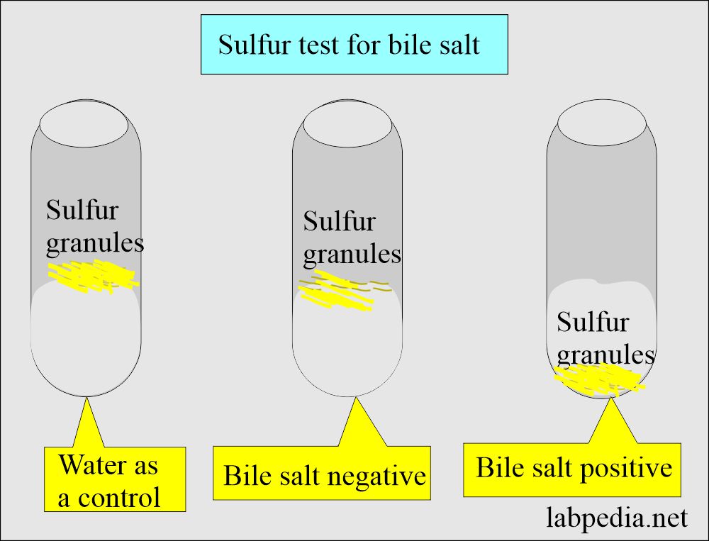 Urine Bile Salts and Bile Acid Metabolism