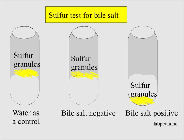 UrineBile Salts in The Urine (Bile Acid Metabolism)