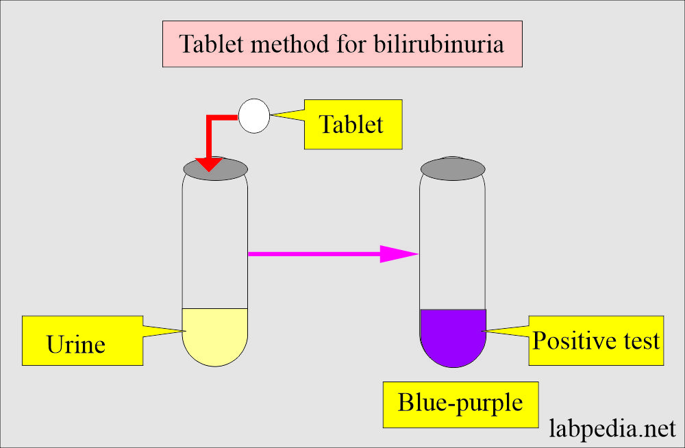 Urine bilirubin tablet test