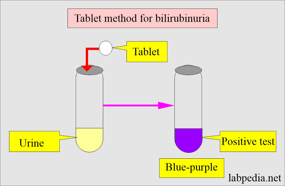 can unconjugated bilirubin be excreted in urine