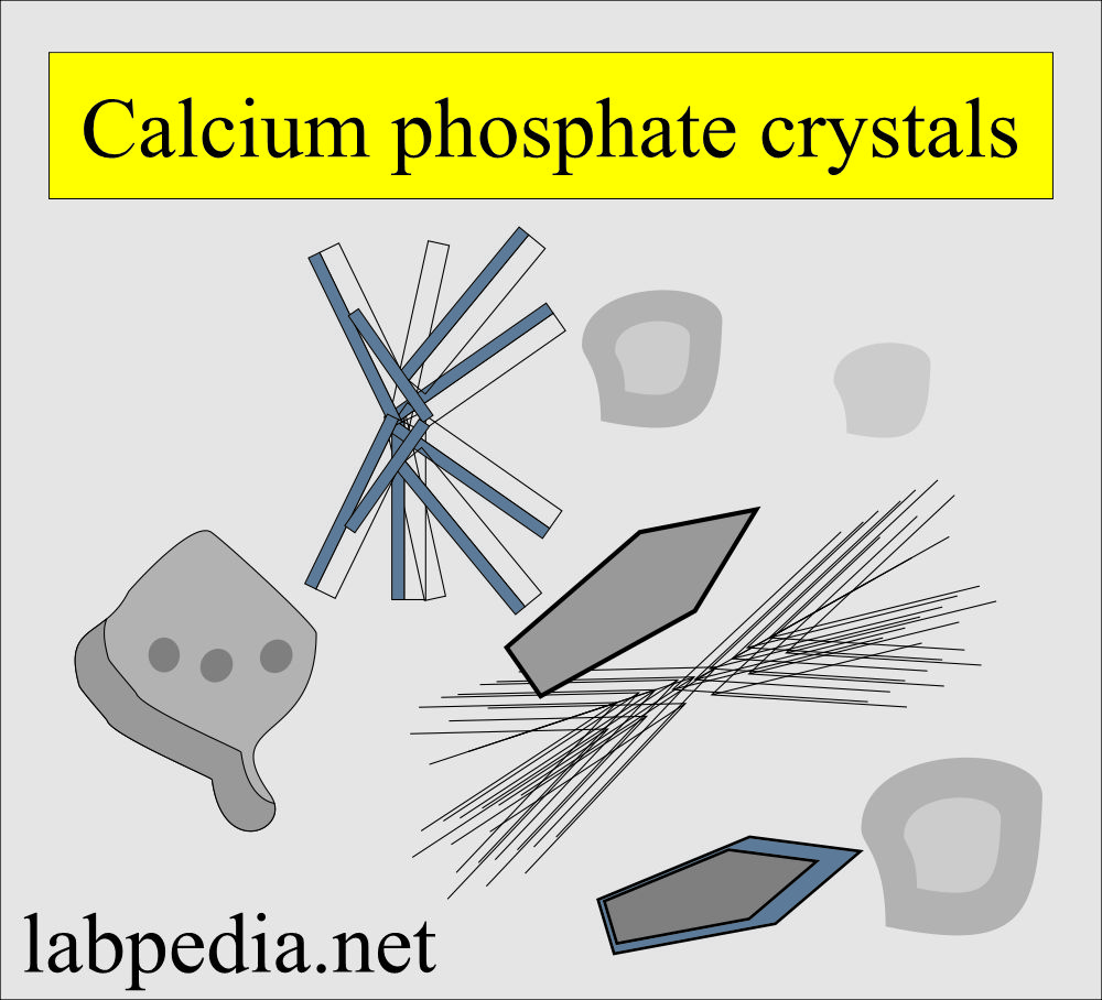 Urine calcium phosphate crystals