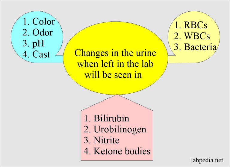 Urine changes When Urine Left at Room Temperature and without preservative