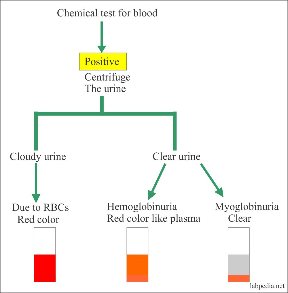 Urine blood chemical test positive