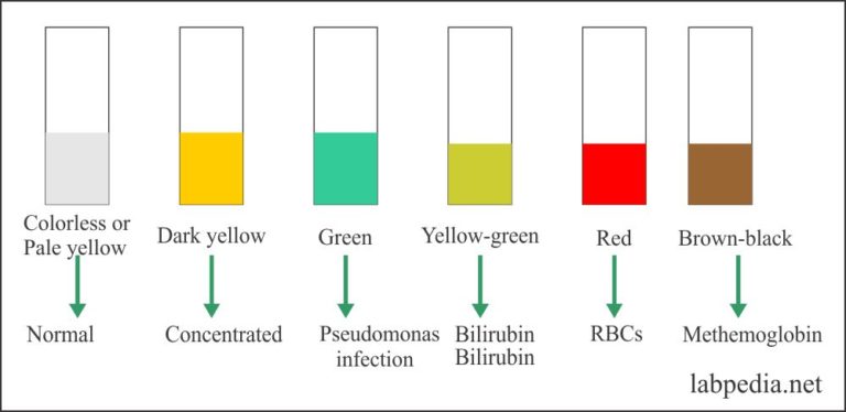 Urine Analysis – part 4 – Urine Analysis, Urine Physical characters ...