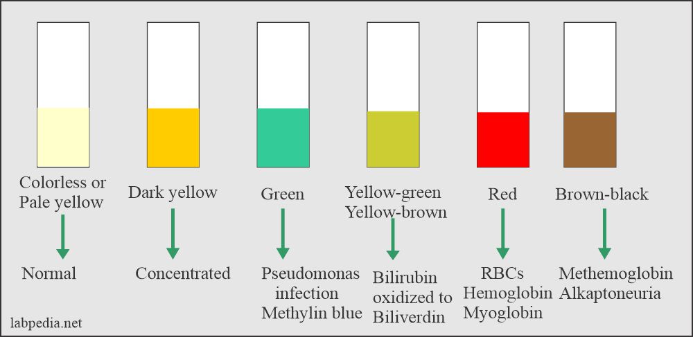 Urine Normal Values, and Their Significance - Labpedia.net