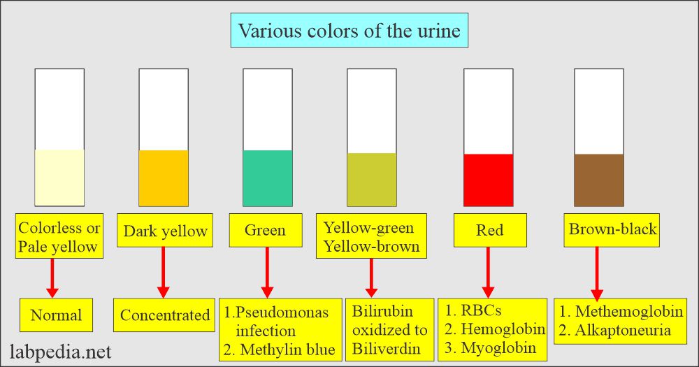 Urine physical examination, Various colors of the urine