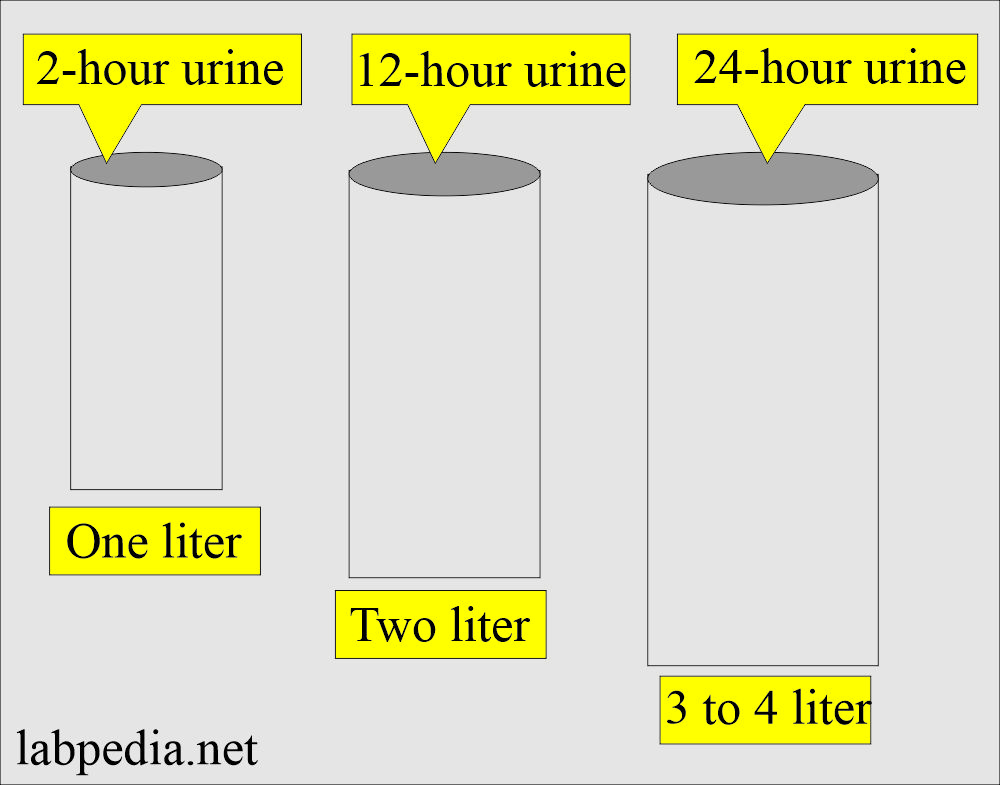 Urine 24-hour: Urine containers