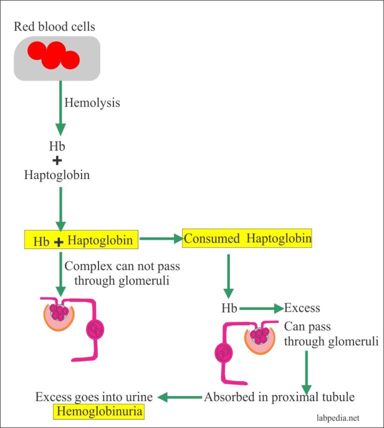 Hemoglobin in Urine