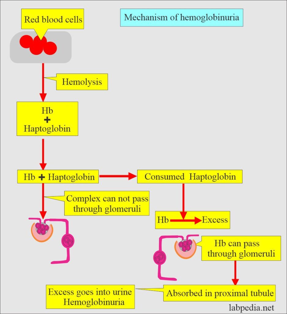 urine-hemoglobin-hemoglobinuria-labpedia