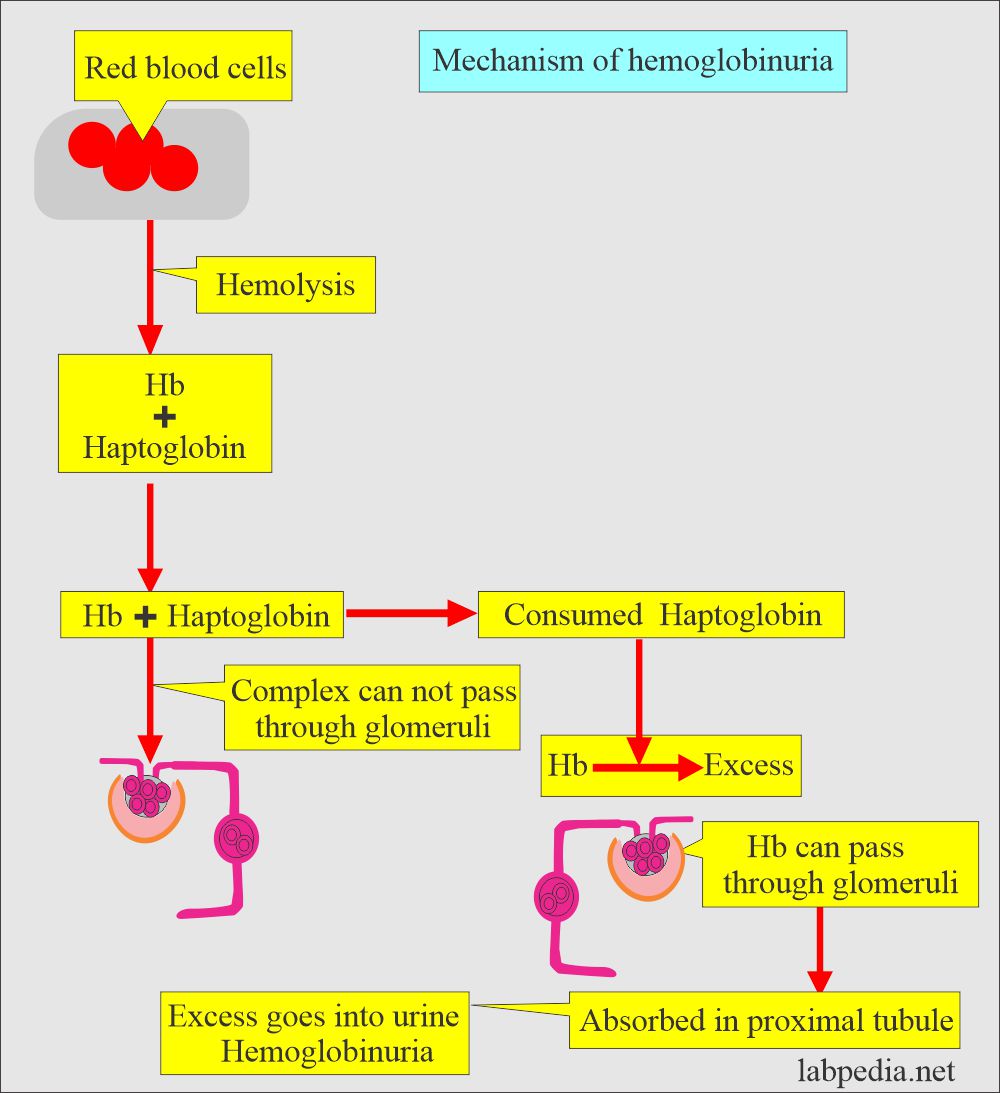 Urine hemoglobin: Urine hemoglobinuria mechanism