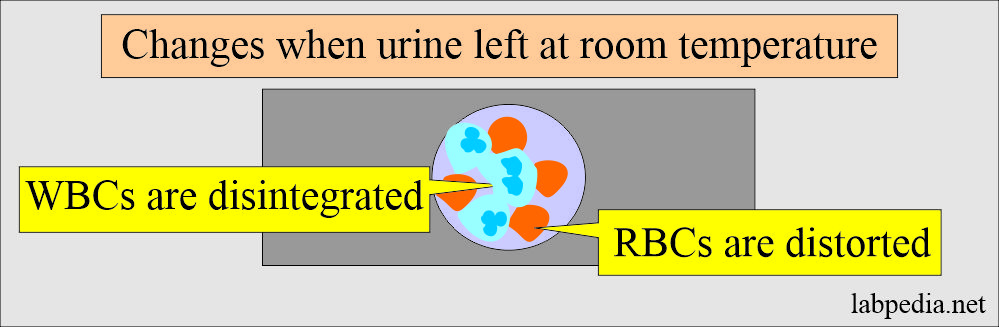 Urine when left at room temperature