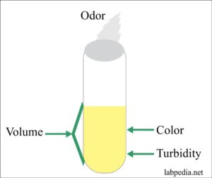 urine labpedia