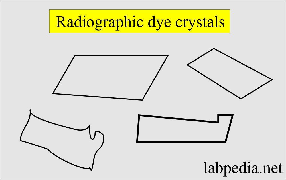 Urine radiographic dye crystals
