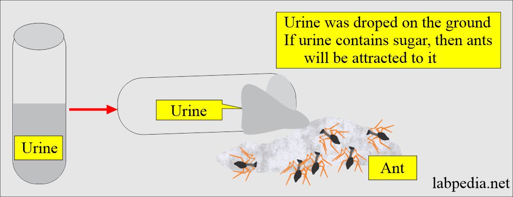 Urine sugar test in ancient time