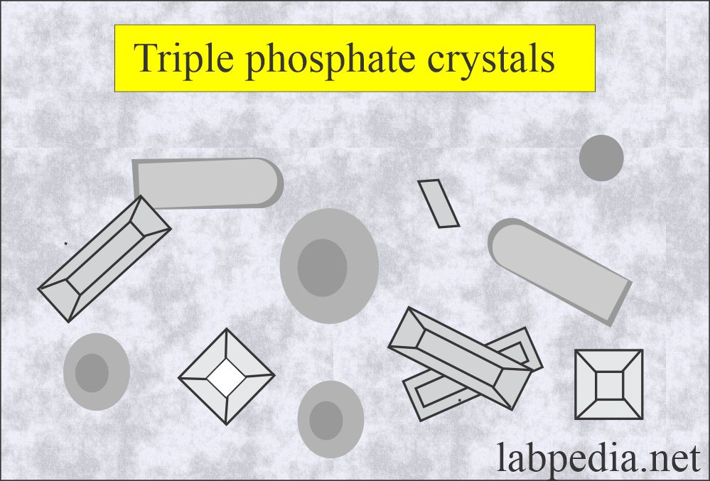 Urine triple phosphate