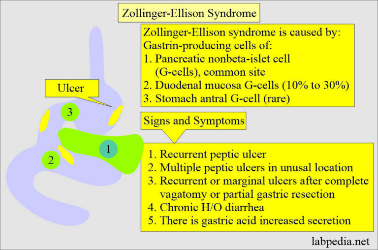 Gastrin Level, and ZollingerEllison Syndrome